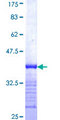 MTMR12 Protein - 12.5% SDS-PAGE Stained with Coomassie Blue.