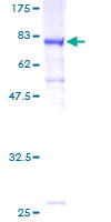 MTMR14 Protein - 12.5% SDS-PAGE of human FLJ22405 stained with Coomassie Blue