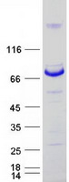 MTMR14 Protein - Purified recombinant protein MTMR14 was analyzed by SDS-PAGE gel and Coomassie Blue Staining