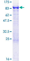 MTMR2 Protein - 12.5% SDS-PAGE of human MTMR2 stained with Coomassie Blue