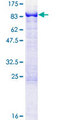 MTMR2 Protein - 12.5% SDS-PAGE of human MTMR2 stained with Coomassie Blue