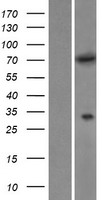 MTMR6 Protein - Western validation with an anti-DDK antibody * L: Control HEK293 lysate R: Over-expression lysate