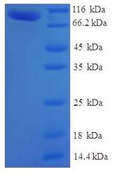 MTMR7 Protein