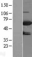 MTMR9 Protein - Western validation with an anti-DDK antibody * L: Control HEK293 lysate R: Over-expression lysate