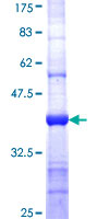 MTMR9 Protein - 12.5% SDS-PAGE Stained with Coomassie Blue.