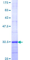 MTNR1A / Melatonin Receptor 1a Protein - 12.5% SDS-PAGE Stained with Coomassie Blue.
