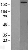 MTOR Protein - Western validation with an anti-DDK antibody * L: Control HEK293 lysate R: Over-expression lysate