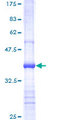 MTOR Protein - 12.5% SDS-PAGE Stained with Coomassie Blue.