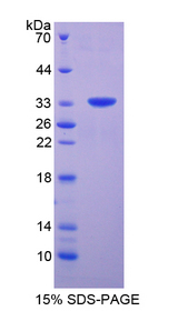 MTOR Protein - Recombinant  FK506 Binding Protein 12 Rapamycin Associated Protein By SDS-PAGE