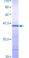 MTSS1 / MIM Protein - 12.5% SDS-PAGE Stained with Coomassie Blue.
