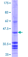 MTTP / MTP Protein - 12.5% SDS-PAGE Stained with Coomassie Blue.