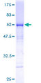 MTUS1 Protein - 12.5% SDS-PAGE of human MTUS1 stained with Coomassie Blue