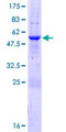 MTX2 Protein - 12.5% SDS-PAGE of human MTX2 stained with Coomassie Blue