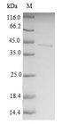 MTX2 Protein - (Tris-Glycine gel) Discontinuous SDS-PAGE (reduced) with 5% enrichment gel and 15% separation gel.
