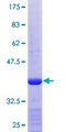 MTX2 Protein - 12.5% SDS-PAGE Stained with Coomassie Blue.