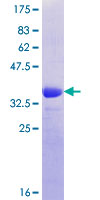 MUC12 Protein - 12.5% SDS-PAGE Stained with Coomassie Blue.