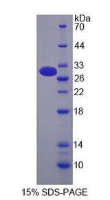 MUC13 Protein - Recombinant Mucin 13, Cell Surface Associated By SDS-PAGE