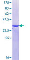 MUC16 / CA125 Protein - 12.5% SDS-PAGE Stained with Coomassie Blue.