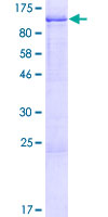 MUC20 Protein - 12.5% SDS-PAGE of human MUC20 stained with Coomassie Blue