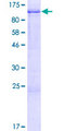 MUC20 Protein - 12.5% SDS-PAGE of human MUC20 stained with Coomassie Blue