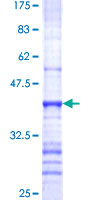 MUC4 Protein - 12.5% SDS-PAGE Stained with Coomassie Blue.