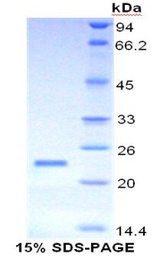 MUC4 Protein - Recombinant Mucin 4 By SDS-PAGE