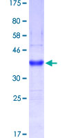 MUC5B Protein - 12.5% SDS-PAGE Stained with Coomassie Blue.