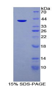 MUC6 / MUC-6 Protein - Recombinant Mucin 6 By SDS-PAGE