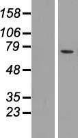 Mucolipin 2 / MCOLN2 Protein - Western validation with an anti-DDK antibody * L: Control HEK293 lysate R: Over-expression lysate