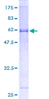 MUL1 / MULAN Protein - 12.5% SDS-PAGE of human FLJ12875 stained with Coomassie Blue