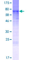 MURC Protein - 12.5% SDS-PAGE of human LOC347273 stained with Coomassie Blue