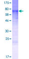 MURC Protein - 12.5% SDS-PAGE of human LOC347273 stained with Coomassie Blue