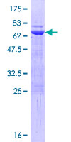 MURF1 / IRF Protein - 12.5% SDS-PAGE of human TRIM63 stained with Coomassie Blue