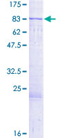 MUS81 Protein - 12.5% SDS-PAGE of human MUS81 stained with Coomassie Blue