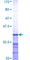 MUS81 Protein - 12.5% SDS-PAGE Stained with Coomassie Blue.