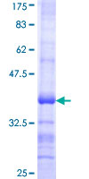 MUSK Protein - 12.5% SDS-PAGE Stained with Coomassie Blue.