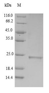 MUT / MCM Protein - (Tris-Glycine gel) Discontinuous SDS-PAGE (reduced) with 5% enrichment gel and 15% separation gel.