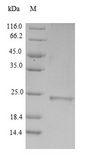 MUT / MCM Protein - (Tris-Glycine gel) Discontinuous SDS-PAGE (reduced) with 5% enrichment gel and 15% separation gel.