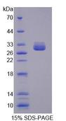 MUT / MCM Protein - Recombinant Methylmalonyl Coenzyme A Mutase (MUT) by SDS-PAGE