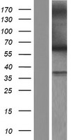 MUTYH / MYH Protein - Western validation with an anti-DDK antibody * L: Control HEK293 lysate R: Over-expression lysate