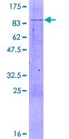 MUTYH / MYH Protein - 12.5% SDS-PAGE of human MUTYH stained with Coomassie Blue