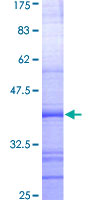 MUTYH / MYH Protein - 12.5% SDS-PAGE Stained with Coomassie Blue.