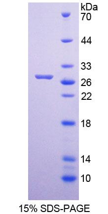 MUTYH / MYH Protein - Recombinant  MutY Homolog By SDS-PAGE