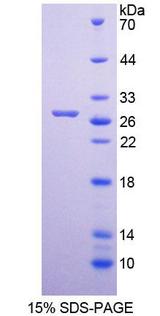 MUTYH / MYH Protein - Recombinant  MutY Homolog By SDS-PAGE