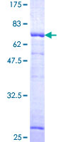 MVD Protein - 12.5% SDS-PAGE of human MVD stained with Coomassie Blue