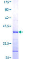 MVD Protein - 12.5% SDS-PAGE Stained with Coomassie Blue.