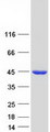 MVD Protein - Purified recombinant protein MVD was analyzed by SDS-PAGE gel and Coomassie Blue Staining