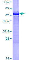 MVK Protein - 12.5% SDS-PAGE of human MVK stained with Coomassie Blue