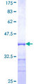 MVK Protein - 12.5% SDS-PAGE Stained with Coomassie Blue.
