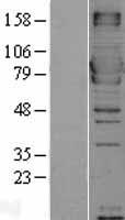 MX1 / MX Protein - Western validation with an anti-DDK antibody * L: Control HEK293 lysate R: Over-expression lysate